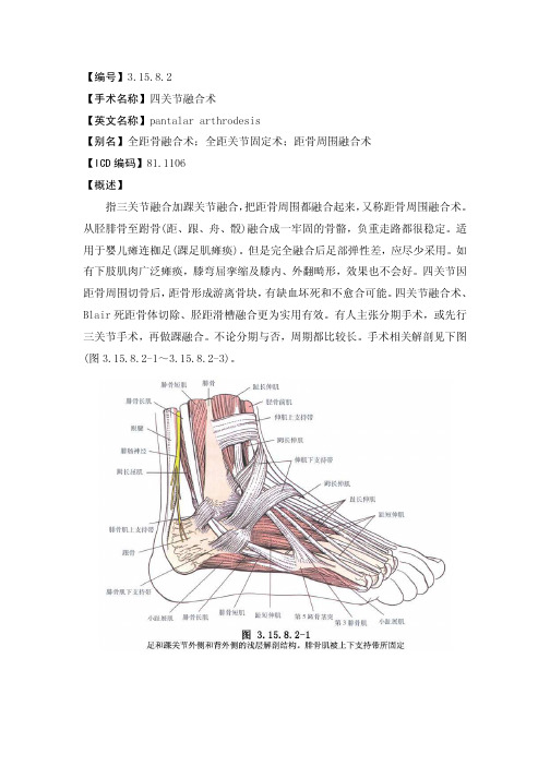 手术_3.15.8.2 四关节融合术