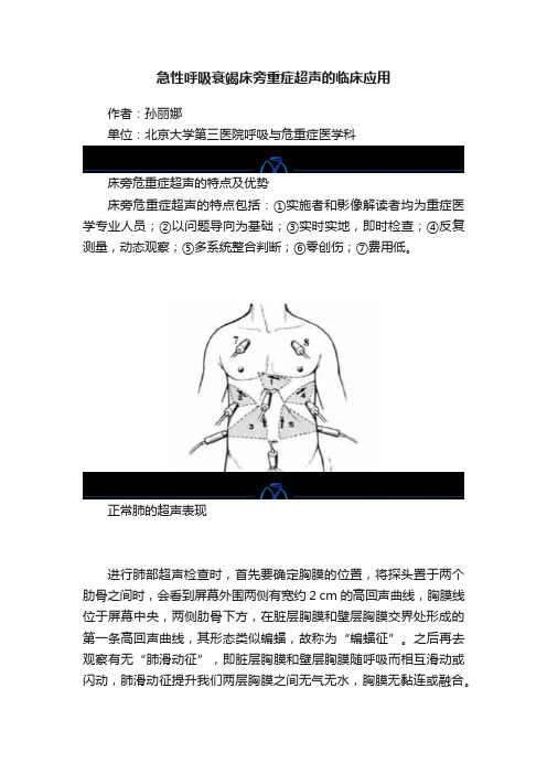 急性呼吸衰竭床旁重症超声的临床应用