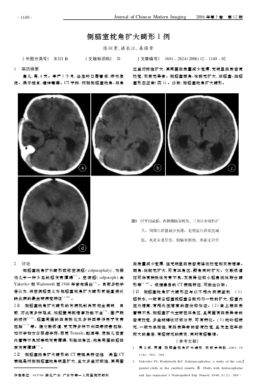 侧脑室枕角扩大畸形1例