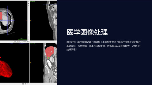 《医学图像处理(附PPT课件及源代码)》