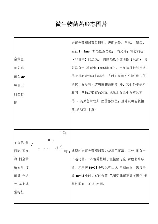 微生物菌落特征形态等总结大全(表格带图片)