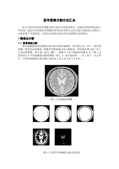 医学图像分割方法汇总.