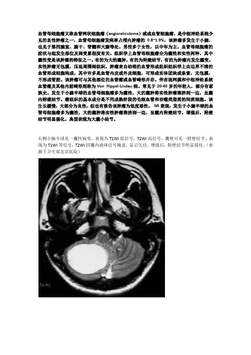 血管母细胞瘤