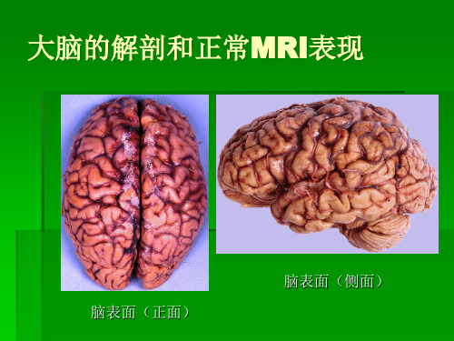 大脑的解剖和正常MRI表现ppt课件