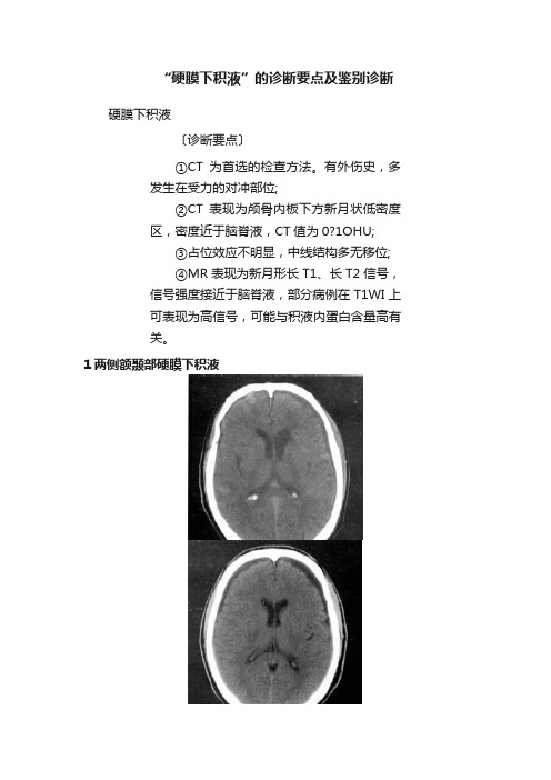 “硬膜下积液”的诊断要点及鉴别诊断