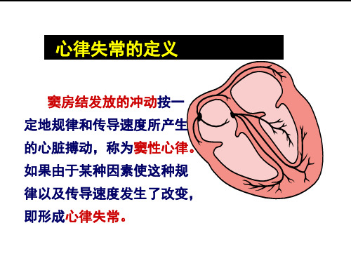 常见心律失常诊断与治疗ppt课件