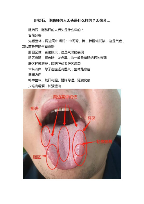 胆结石、脂肪肝的人舌头是什么样的？舌像分...