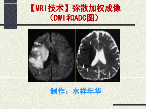 MRI技术--弥散加权成像(DWI和ADC图)