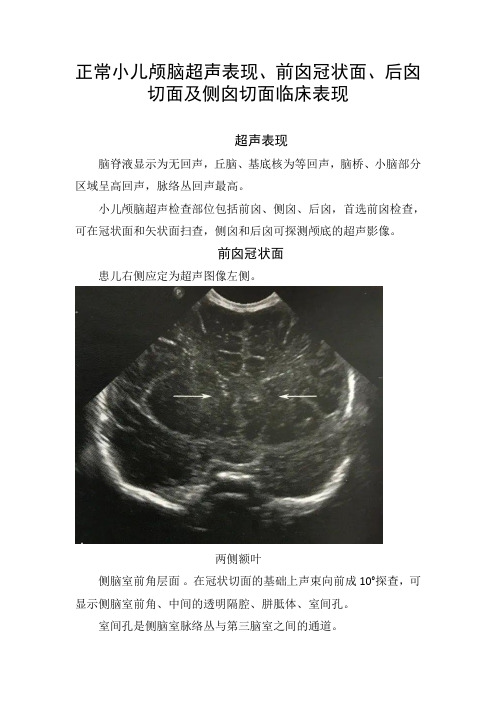 正常小儿颅脑超声表现、前囟冠状面、后囟切面及侧囟切面临床表现