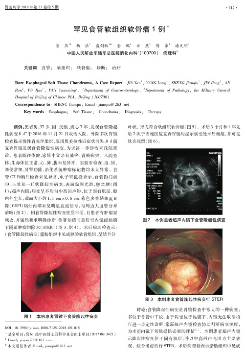 罕见食管软组织软骨瘤1例