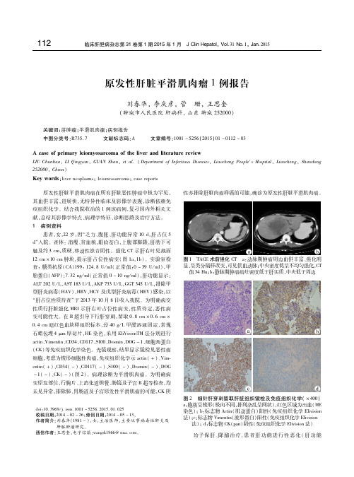 原发性肝脏平滑肌肉瘤1例报告 刘春华