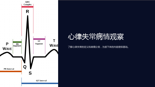 心律失常病情观察