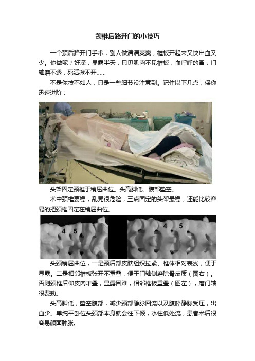 颈椎后路开门的小技巧