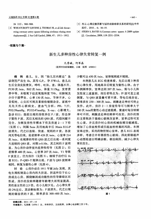 新生儿多种房性心律失常转复一例