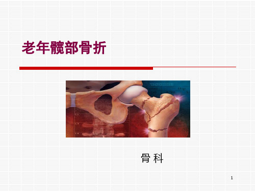 老年髋部骨折ppt课件