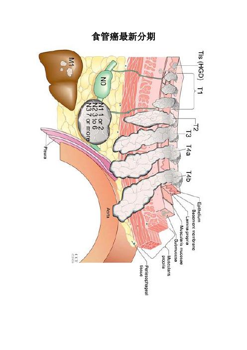 食管癌最新分期