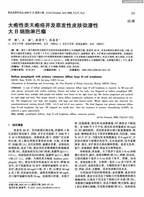 大疱性类天疱疮并发原发性皮肤弥漫性大B细胞淋巴瘤