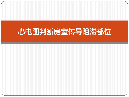 心电图判断房室传导阻滞部位