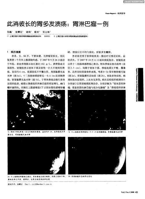 此消彼长的胃多发溃疡：胃淋巴瘤一例