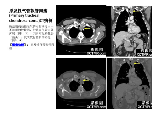 胸部影像学ppt课件