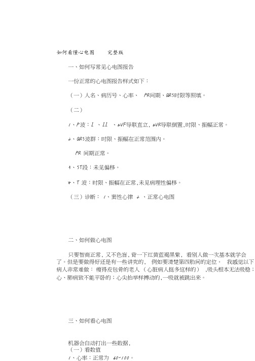 如何看懂心电图完整版.pdf