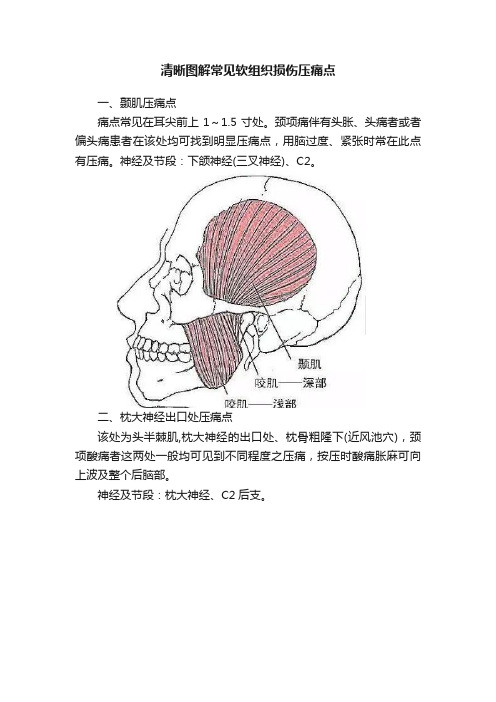 清晰图解常见软组织损伤压痛点