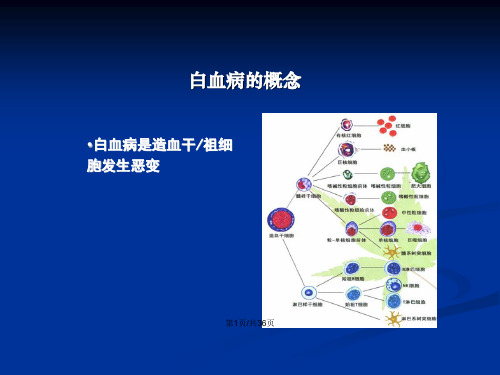 常见血液病急性白血病的MICM分型和预后