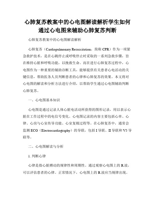 心肺复苏教案中的心电图解读解析学生如何通过心电图来辅助心肺复苏判断