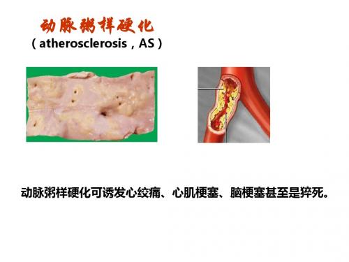 调脂与抗动脉粥样硬化药