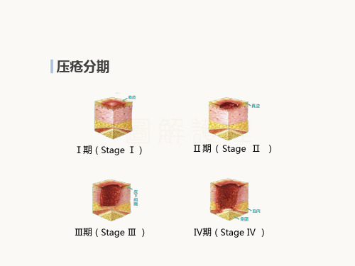 压疮疼痛评估ppt课件