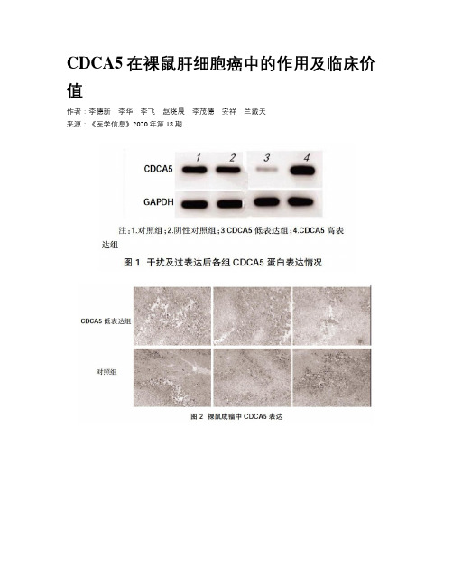 CDCA5在裸鼠肝细胞癌中的作用及临床价值