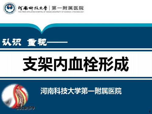 支架内血栓的形成与防治