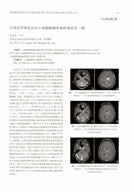 应用安罗替尼治疗小细胞肺癌伴脑转移患者一例