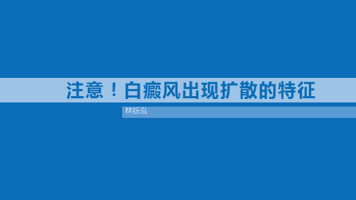 注意!白癜风出现扩散的特征