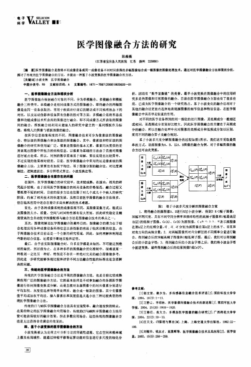 医学图像融合方法的研究