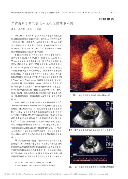 产前超声诊断双胎之一无心无脑畸形一例