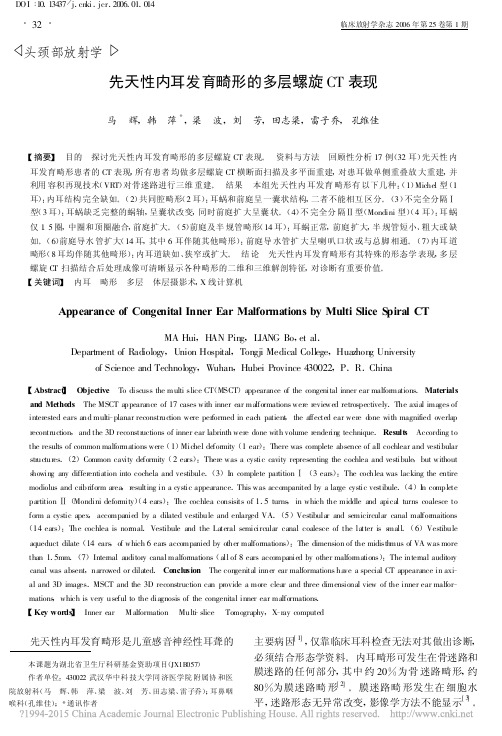 先天性内耳发育畸形的多层螺旋CT表现