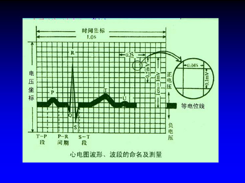 c1、正常心电图