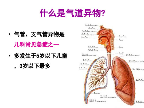 异物急救方法ppt课件