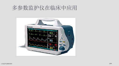 心电监护仪器的使用