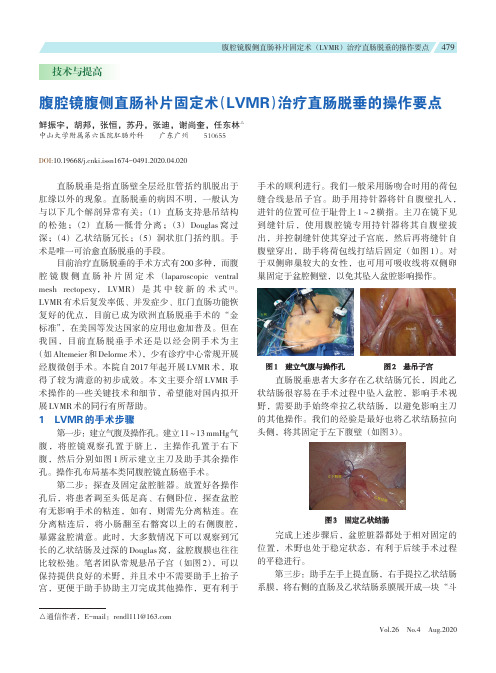 腹腔镜腹侧直肠补片固定术(LVMR)治疗直肠脱垂的操作要点