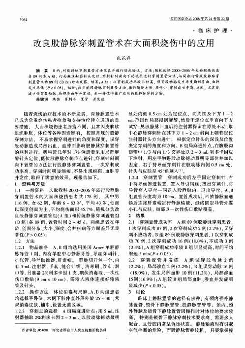 改良股静脉穿刺置管术在大面积烧伤中的应用