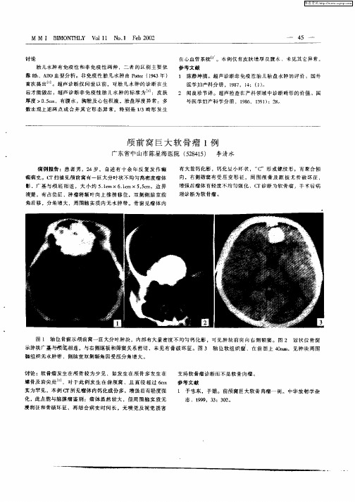 颅前窝巨大软骨瘤1例