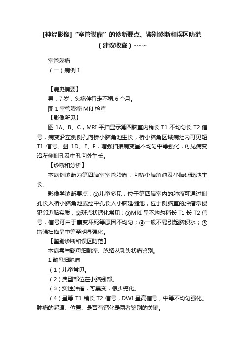 [神经影像]“室管膜瘤”的诊断要点、鉴别诊断和误区防范（建议收藏）~~~