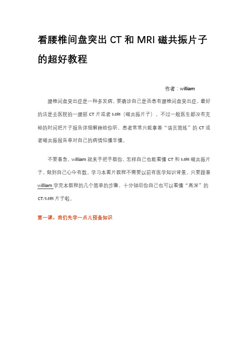 看腰椎间盘突出CT和MRI磁共振片子的超好教程