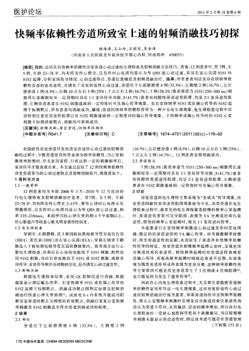 快频率依赖性旁道所致室上速的射频消融技巧初探