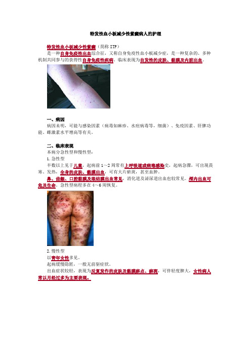 特发性血小板减少性紫癜病人的护理考点总结