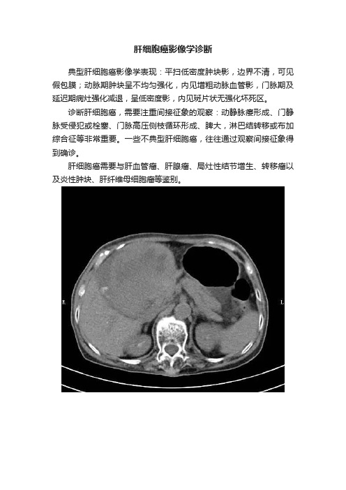 肝细胞癌影像学诊断