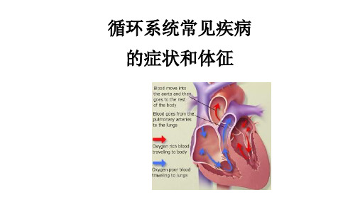 循环系统疾病常见症状和体征 触诊 叩诊 视诊诊断治疗