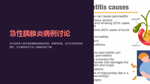 急性胰腺炎病例讨论